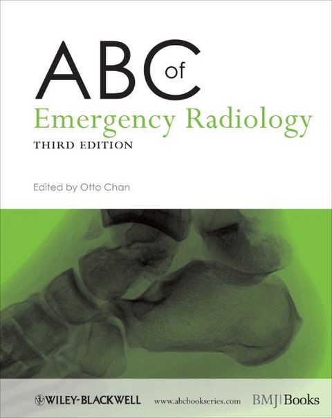 ABC of Emergency Radiology - 