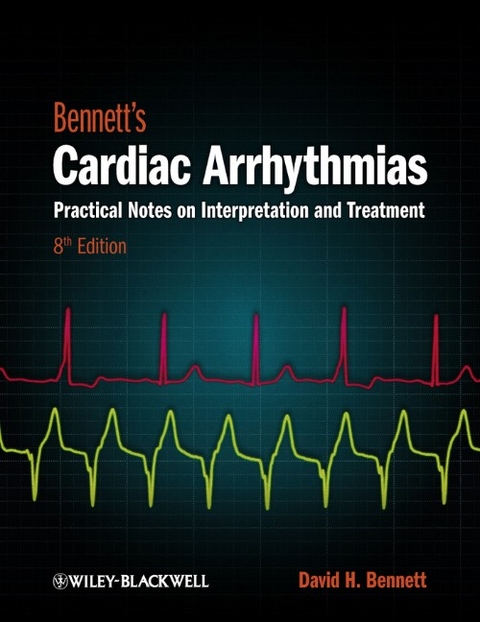 Bennett's Cardiac Arrhythmias -  David H. Bennett