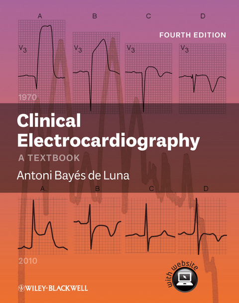 Clinical Electrocardiography -  Antoni Bay&  eacute;  s de Luna