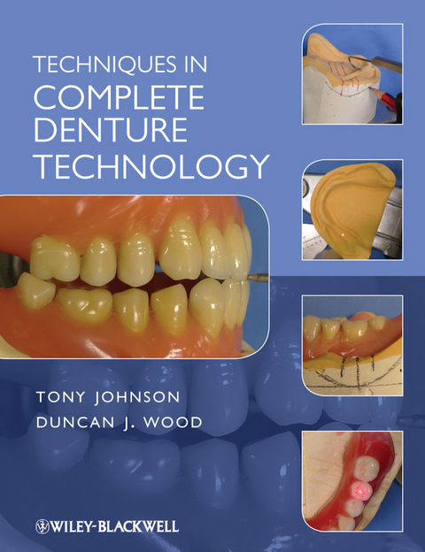 Techniques in Complete Denture Technology -  Duncan J. Wood