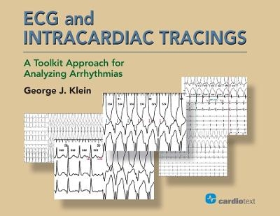 ECG and Intracardiac Tracings - George J Klein