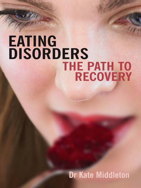 Eating Disorders -  Kate Middleton