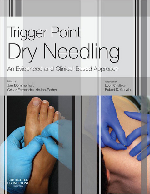 Trigger Point Dry Needling E-Book -  Jan Dommerholt,  Cesar Fernandez de las Penas