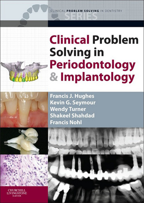 Clinical Problem Solving in Periodontology and Implantology - E-Book -  Francis J. Hughes,  Francis Nohl,  Professor Kevin G. Seymour,  Shakeel Shahdad,  Wendy Turner