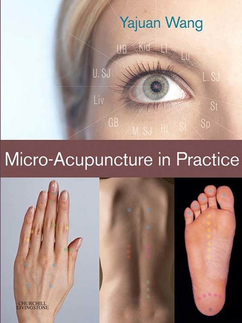 Micro-Acupuncture in Practice -  Yajuan Wang