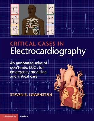 Critical Cases in Electrocardiography - Steven R. Lowenstein