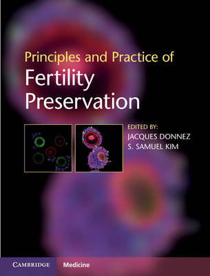 Principles and Practice of Fertility Preservation - 