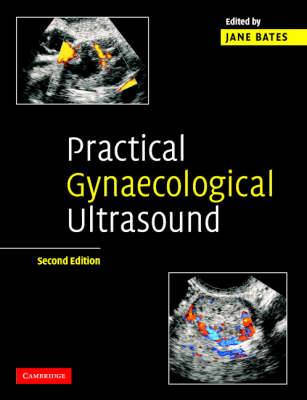 Practical Gynaecological Ultrasound - 