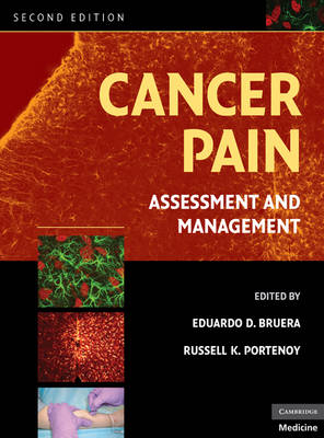 Cancer Pain - 
