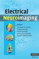 Electrical Neuroimaging - 