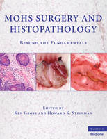 Mohs Surgery and Histopathology - 