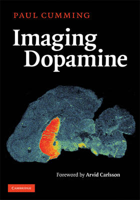 Imaging Dopamine -  Paul Cumming