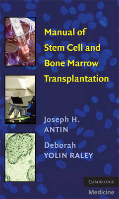 Manual of Stem Cell and Bone Marrow Transplantation -  Joseph H. Antin,  Deborah Yolin Raley