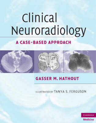 Clinical Neuroradiology -  Gasser M. Hathout