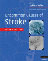 Uncommon Causes of Stroke - 