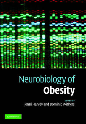 Neurobiology of Obesity - 