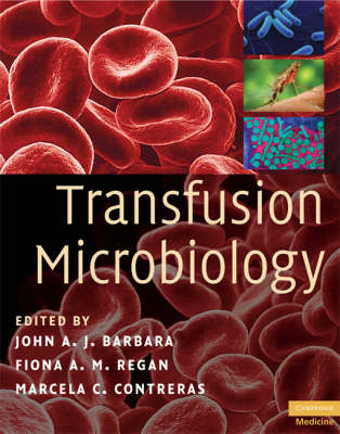 Transfusion Microbiology - 