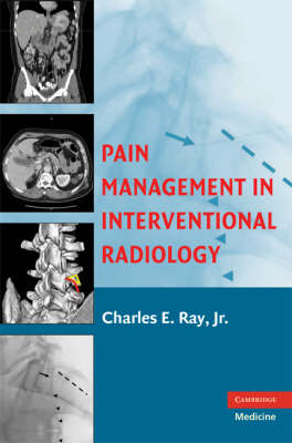 Pain Management in Interventional Radiology - 