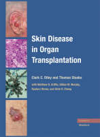 Skin Disease in Organ Transplantation - 