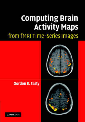Computing Brain Activity Maps from fMRI Time-Series Images -  Gordon E. Sarty
