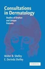 Consultations in Dermatology -  E. Dorinda Shelley,  Walter B. Shelley