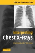 Interpreting Chest X-Rays -  Foong-Koon Cheah,  Philip Eng