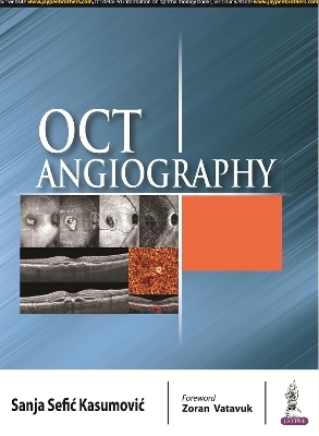 OCT Angiography - Sanja Sefic Kasumovic