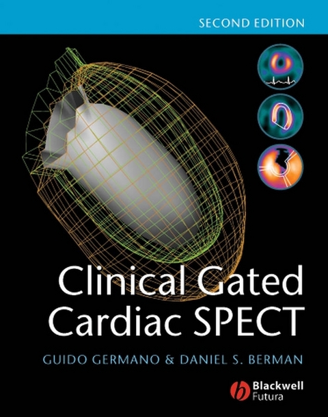 Clinical Gated Cardiac SPECT -  Daniel S. Berman,  Guido Germano