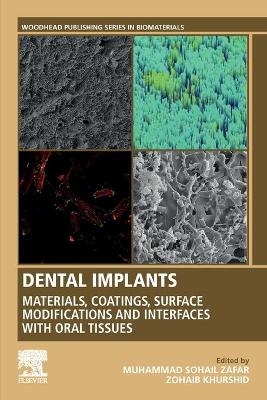 Dental Implants - Muhammad Zafar, ZOHAIB KHURSHID