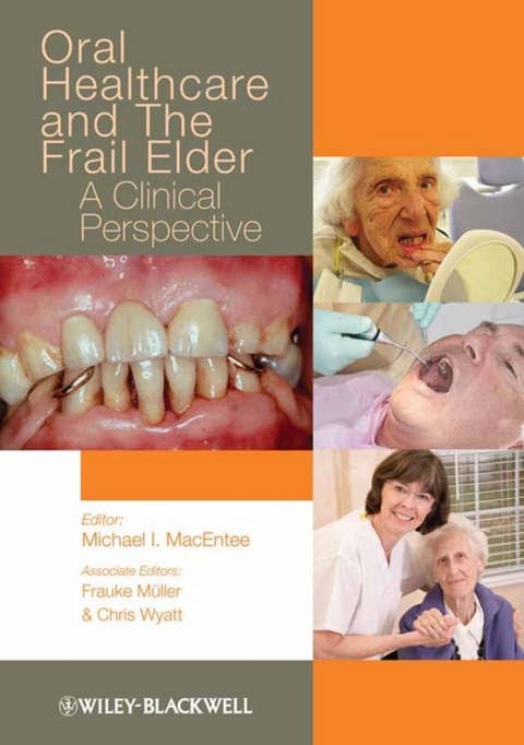 Oral Healthcare and the Frail Elder - 