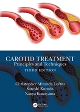 Carotid Treatment: Principles and Techniques - Loftus, Christopher Miranda; Kuroda, Satoshi; Kuwayama, Naoya