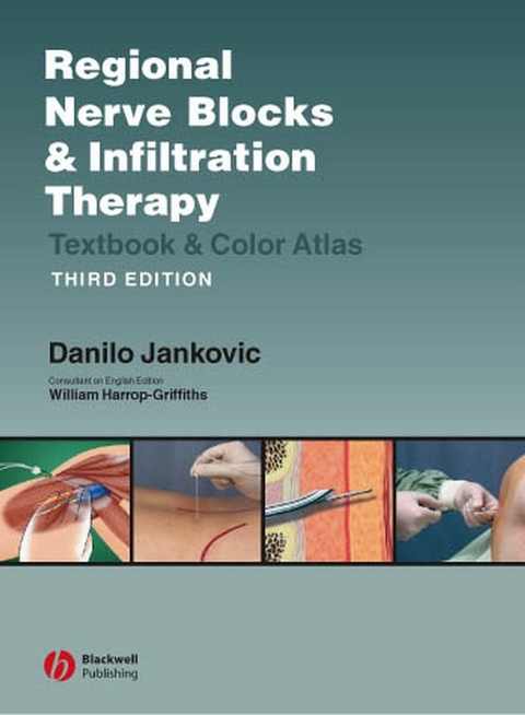 Regional Nerve Blocks And Infiltration Therapy - 