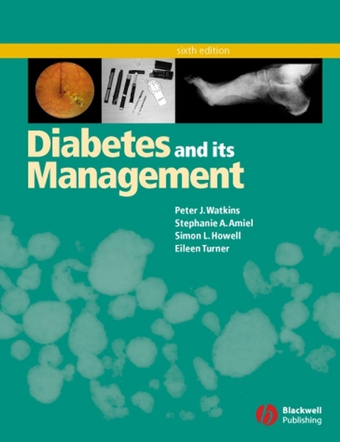 Diabetes and Its Management -  Stephanie A. Amiel,  Simon L. Howell,  Eileen Turner,  Peter J. Watkins
