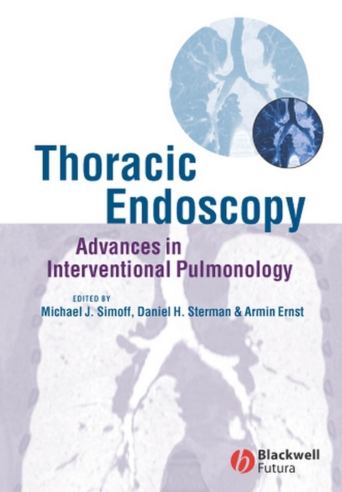 Thoracic Endoscopy - 