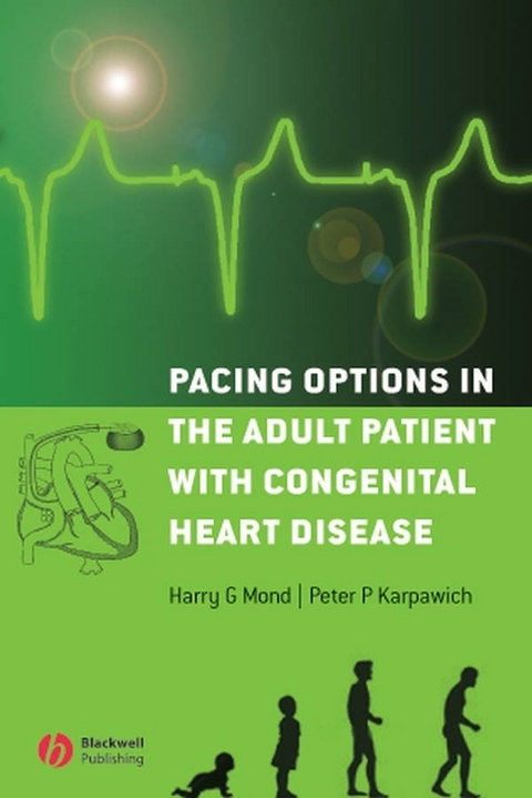 Pacing Options in the Adult Patient with Congenital Heart Disease -  Peter P. Karpawich,  Harry G. Mond
