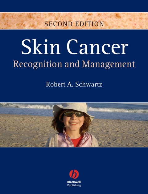 Skin Cancer -  Robert A. Schwartz