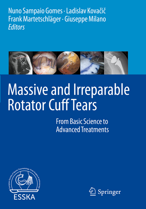 Massive and Irreparable Rotator Cuff Tears - 