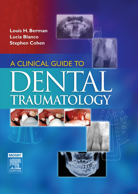 Clinical Guide to Dental Traumatology - E-Book -  Louis H. Berman,  Lucia Blanco,  Stephen Cohen