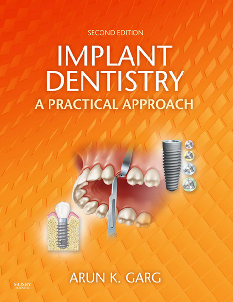 Implant Dentistry - E-Book -  Arun K. Garg
