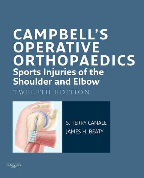 Campbell's Operative Orthopaedics: Sports Injuries of the Shoulder and Elbow E-Book -  James H. Beaty,  S. Terry Canale