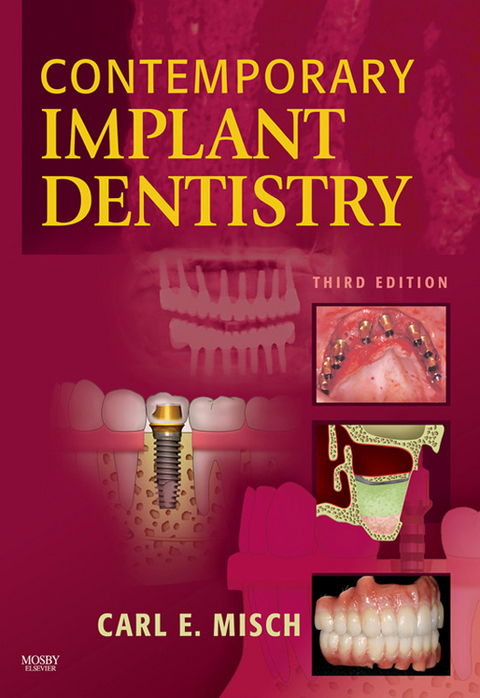 Contemporary Implant Dentistry -  Carl E. Misch