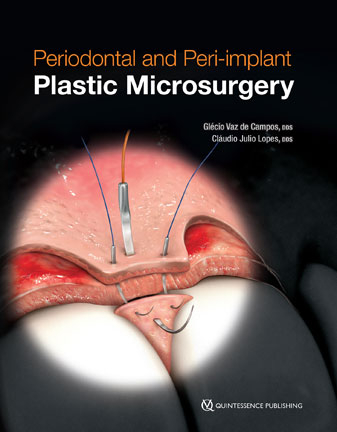 Periodontal and Peri-Implant Microsurgery - Glecia Vas de Campos