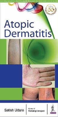 Atopic Dermatitis - Satish Udare