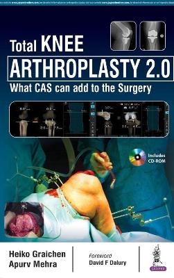 Total Knee Arthroplasty 2.0 - Heiko Graichen, Apurv Mehra