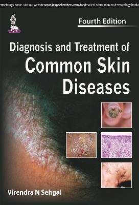 Diagnosis and Treatment of Common Skin Diseases - Virendra N Sehgal