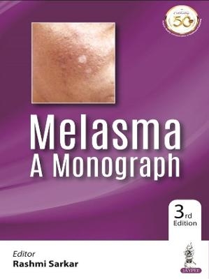 Melasma: A Monograph - Rashmi Sarkar