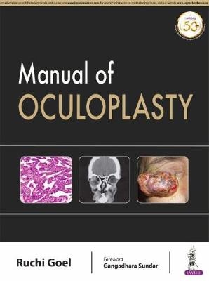 Manual of Oculoplasty - Ruchi Goel