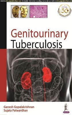 Genitourinary Tuberculosis - Ganesh Gopalakrishnan, Sujata Patwardhan