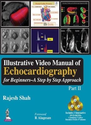 Illustrative Video Manual of Echocardiography for Beginners: A Step by Step Approach (Part II) - Rajesh Shah