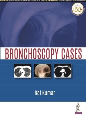 Bronchoscopy Cases - Raj Kumar